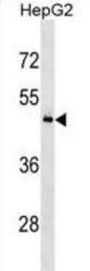 RNA-Binding Protein T-Star (KHDRBS3) Antibody