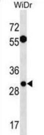 EXOSC6 Antibody