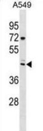 Tripartite Motif-Containing Protei (TRIX3) Antibody