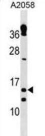 Thioredoxin Reductase 3 Intronic Transcript 1 (TXNRD3IT1) Antibody