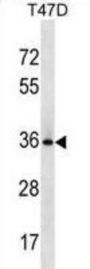 Bcl-2-Like Protein 12 (BCL2L12) Antibody