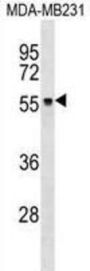 Zinc Finger Protein 737 (ZNF737) Antibody