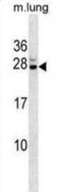Mouse Cbx5 Antibody