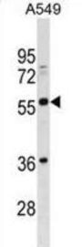 Putative Butyrophilin Subfamily 2 Member A3 (BTN2A3) Antibody