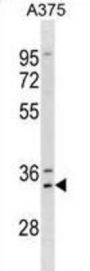 Homeobox Protein MSX-1 (MSX1) Antibody
