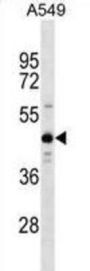 ZNF883 Antibody