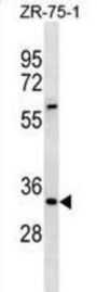 Inhibitor of Growth Protein 2 (ING2) Antibody