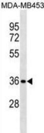 STX11 Antibody