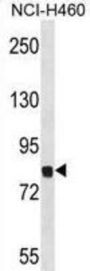 Mouse Dyrk1a Antibody