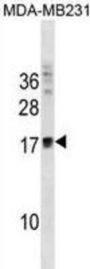 Ankyrin Repeat Domain-Containing Protein 37 (ANKRD37) Antibody