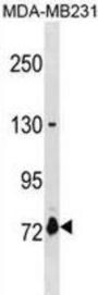 Asparagine Synthetase Domain Containing 1 (ASNSD1) Antibody