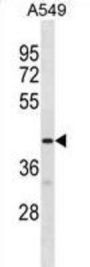 G Protein-Coupled Receptor 52 (GPR52) Antibody
