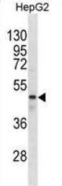 Gamma-Aminobutyric Acid Receptor Subunit Rho-1 (gABRR1) Antibody