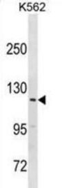 Probable E3 Ubiquitin-Protein Ligase HERC3 (HERC3) Antibody