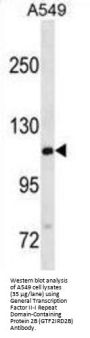 General Transcription Factor II-I Repeat Domain-Containing Protein 2B (GTF2IRD2B) Antibody