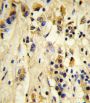 Eukaryotic Translation Initiation Factor 4E Type 2 (EIF4E2) Antibody