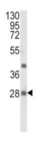 Eukaryotic Translation Initiation Factor 4E Type 2 (EIF4E2) Antibody