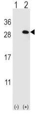 Eukaryotic Translation Initiation Factor 4E Type 2 (EIF4E2) Antibody