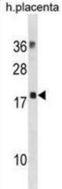 Myosin Light Chain 12B (MYL12B) Antibody