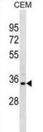 Phosphoribosyl Pyrophosphate Synthetase 1-Like 1 (PRPS1L1) Antibody