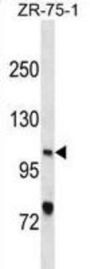Xeroderma Pigmentosum, Complementation Group C (XPC) Antibody