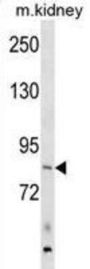 ARHGEF16 Antibody