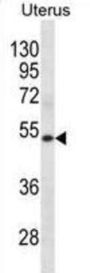 Keratin, Type II Cytoskeletal 72 (KRT72) Antibody
