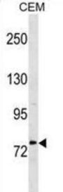 MTHFR Antibody