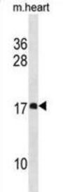 Death Associated Protein Like 1 (DAPL1) Antibody