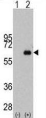 Myc Proto-Oncogene Protein (MYC) Antibody