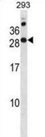 RAP2C, Member of RAS Oncogene Family (RAP2C) Antibody