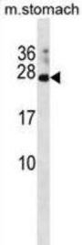 RAP2C, Member of RAS Oncogene Family (RAP2C) Antibody