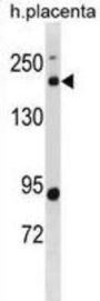 B-Cell CLL/Lymphoma 9 Like Protein (BCL9L) Antibody
