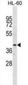 Nuclear Receptor Subfamily 2 Group E Member 1 (NR2E1) Antibody