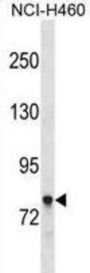 Amphiphysin (AMPH) Antibody