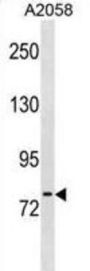 Neurolysin (NLN) Antibody