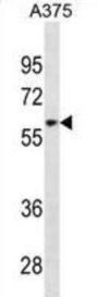 Zinc Finger Protein 394 (ZNF394) Antibody