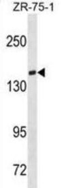 T-Cell Lymphoma Invasion And Metastasis Inducing Protein 1 (TIAM1) Antibody