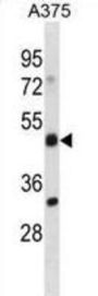 ADRM1 Antibody