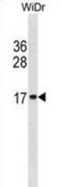 Histone H2B Type 2-E (HIST2H2BE) Antibody