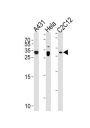 p27Kip1 Antibody