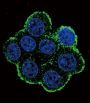 Bone Morphogenetic Protein Receptor 1A (BMPR1A) Antibody