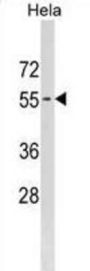 Phosphatidylinositol Glycan Anchor Biosynthesis Class B (PIGB) Antibody
