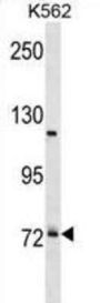 Pre-mRNA Processing Factor 39 (PRPF39) Antibody