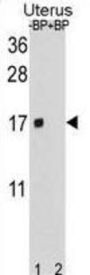 SH3 Domain Binding Glutamic Acid Rich Protein Like Protein (SH3BGRL) Antibody