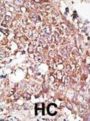 Lymphatic Vessel Endothelial Hyaluronic Acid Receptor 1 (LYVE1) Antibody
