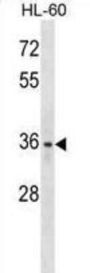 Lymphatic Vessel Endothelial Hyaluronic Acid Receptor 1 (LYVE1) Antibody