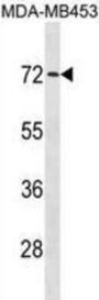 RING-Type E3 Ubiquitin Transferase MEX3C (MEX3C) Antibody