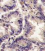 Vascular Endothelial Growth Factor C (VEGFC) Antibody