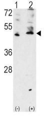 Vascular Endothelial Growth Factor C (VEGFC) Antibody